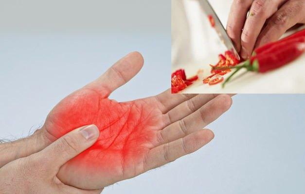 jak pozbyć się bólu pieprzowego w dłoni