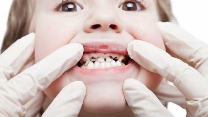 Zadbaj o higienę jamy ustnej swojego dziecka w trakcie semestru!