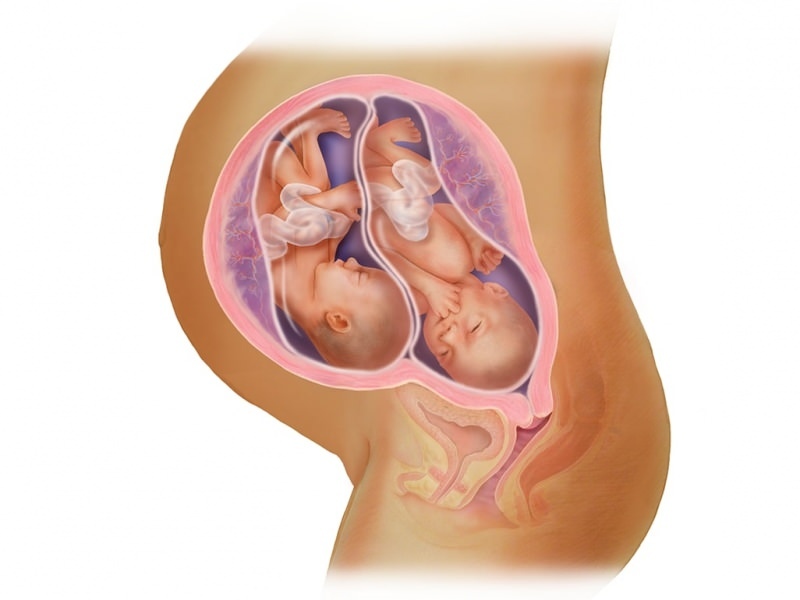 Ciąża bliźniacza w IVF! Co to jest transfer zarodka?