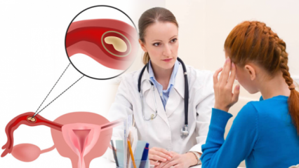 Czym jest ciąża pozamaciczna (ciąża pozamaciczna), dlaczego? Jakie są objawy ciąży pozamacicznej?