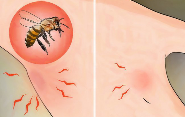 Co to jest alergia na pszczoły i jakie są objawy? Naturalne metody, które są dobre dla użądlenia pszczół