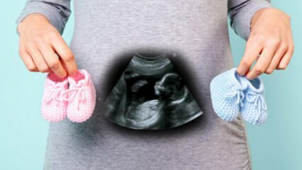 Czy w pierwszym trymestrze ciąży zostanie ustalona płeć dziecka?