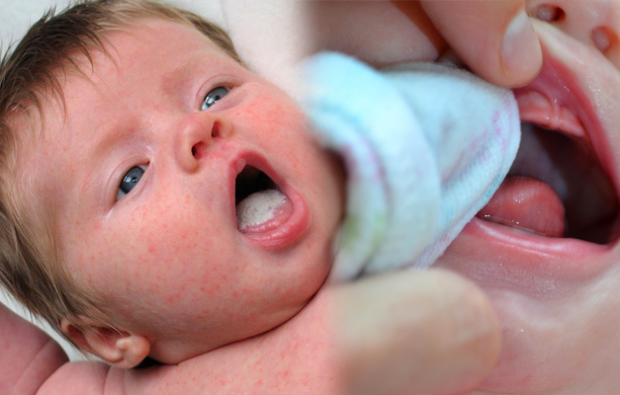 Jakie są owrzodzenia jamy ustnej u niemowląt