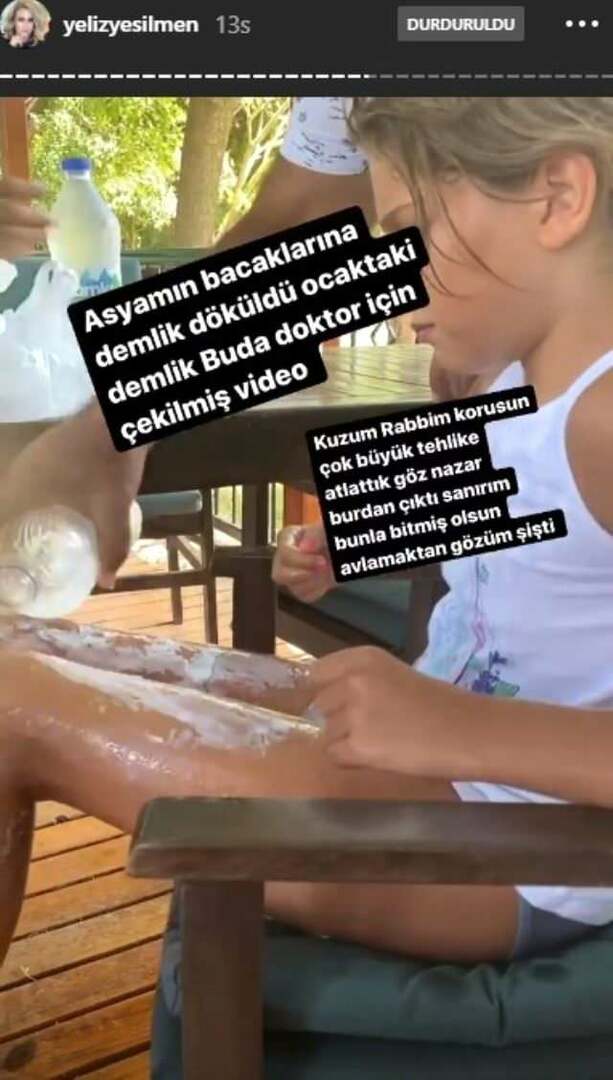 Wrzątkiem polano nogi córki Yeliz Yeşilmen