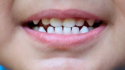 Jak uczyć dzieci opieki stomatologicznej?