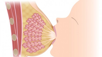 Co to jest mastitis (zapalenie piersi)? Objawy zapalenia wymienia i leczenie w okresie karmienia piersią