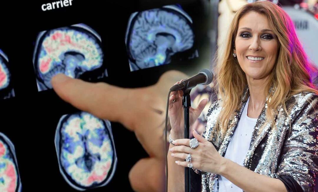 Co to jest zespół sztywnej osoby? Na czym polega choroba Celine Dion?