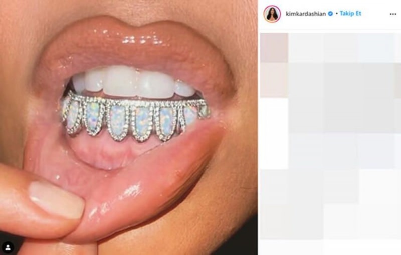 Klejnot dentystyczny Kim Kardashian za 5000 $