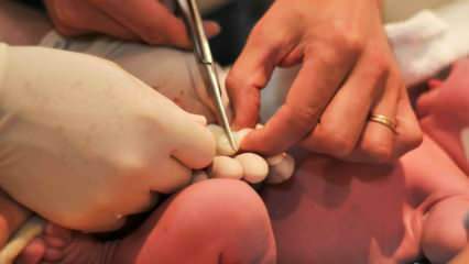 Kiedy dochodzi do przecięcia pępowiny u niemowląt? Korzyści z późnego przecięcia pępowiny