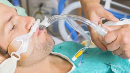 Co to jest intubacja? Co oznacza zaintubowany pacjent? Czy zaintubowany pacjent wyzdrowieje?