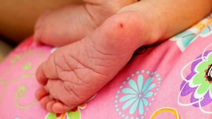 Dlaczego krew pięty jest pobierana u niemowląt? Wymagania dotyczące badania krwi pięty u niemowląt