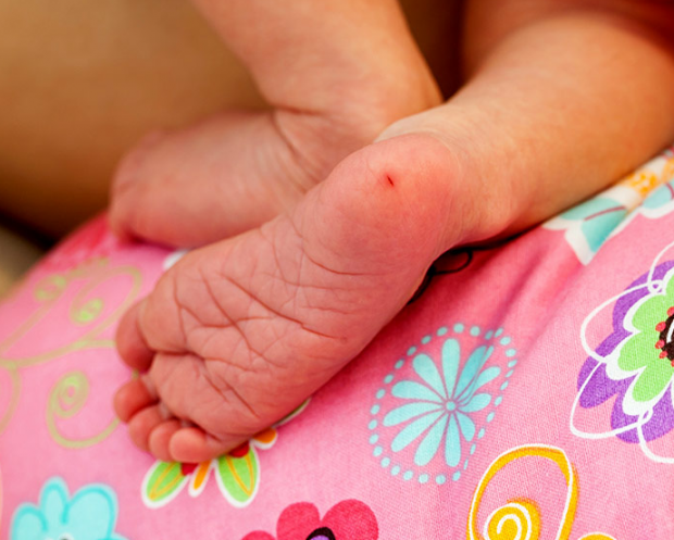 badanie krwi pięty u niemowląt
