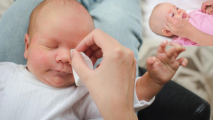 Jak usunąć zadziory u niemowląt? Powoduje zadziory oczu u niemowląt? Masaż zadziorów mlekiem matki
