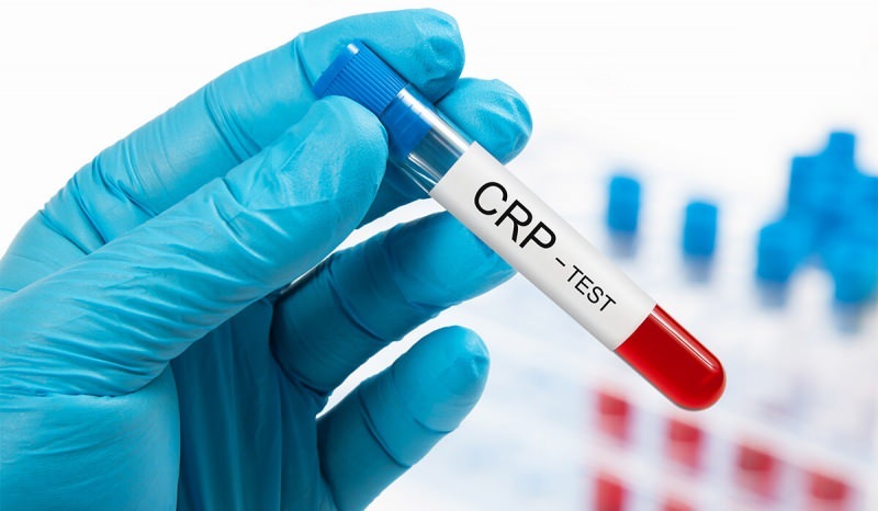 Dlaczego CRP we krwi rośnie? Co to jest CRP? Jak obniżyć CRP?
