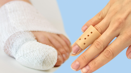 Co powoduje złamanie palca? Jakie są objawy złamania palca?