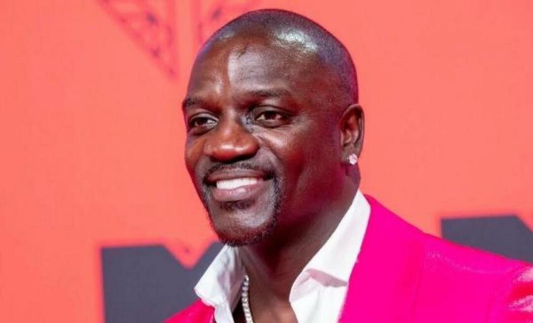 Amerykański piosenkarz Akon również preferował Turcję do przeszczepu włosów! Oto cena, jaką zapłacił...