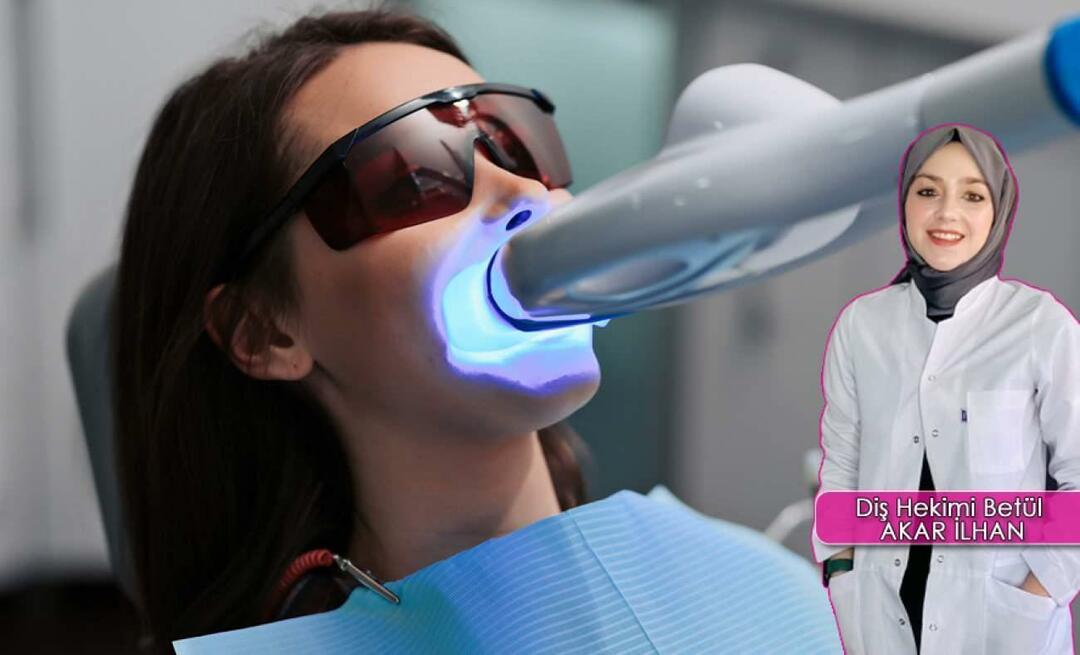 Jak przebiega metoda wybielania zębów (wybielanie)? Czy metoda wybielania niszczy zęby?