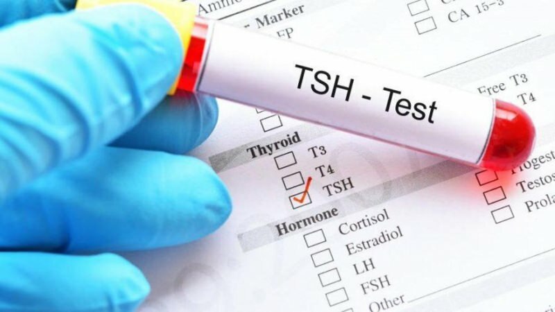 Test tsh to test hormonalny