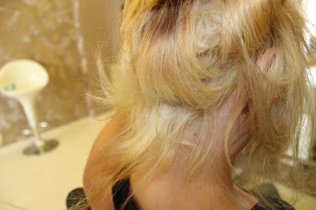 Co się dzieje z płonącymi włosami od środka? Jak pielęgnowane włosy powinny być utrzymywane?