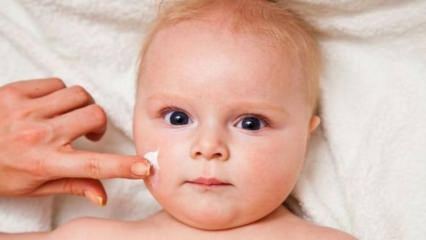 Wskazówki dotyczące pielęgnacji skóry dla niemowląt! Jakie są problemy skórne u niemowląt?