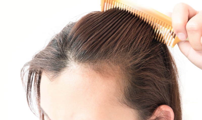 rozwiązania wypadania włosów po porodzie! Co jest dobre na wypadanie włosów?