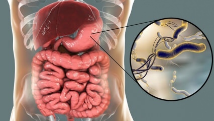 Co to jest Helicobacter Pylori (mikrob żołądkowy)? Choroby wywoływane przez Helicobacter pylori ...