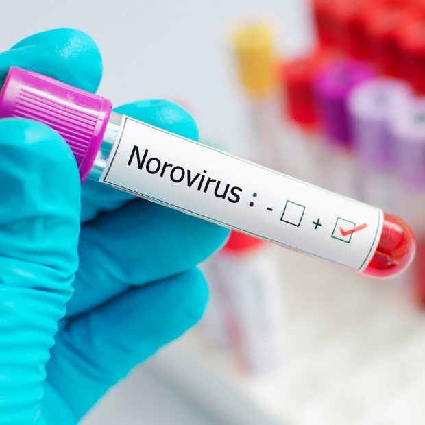 Co to jest norowirus i jakie powoduje choroby? Nieznany o infekcji Norovirus ...