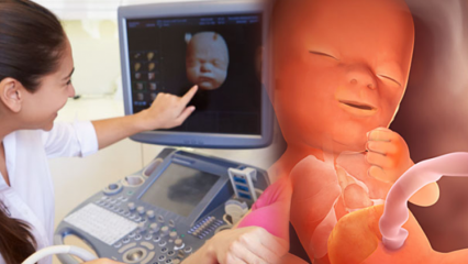 Który organ rozwija się najpierw u niemowląt? Rozwój dziecka tydzień po tygodniu