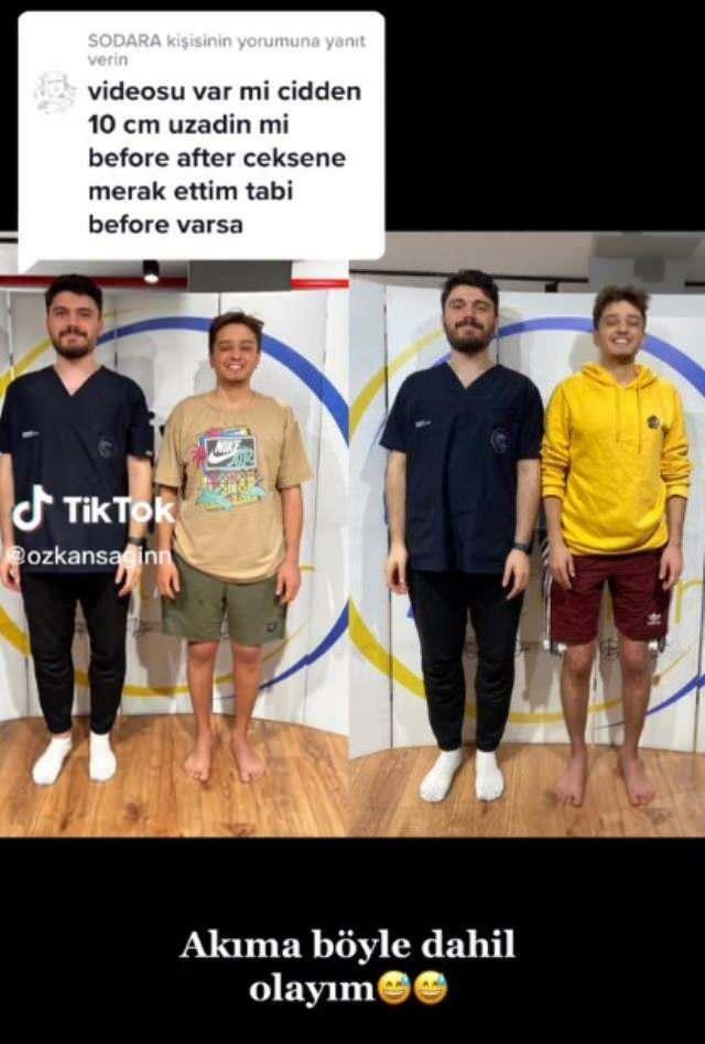 Özkan Sağın przed i po operacji