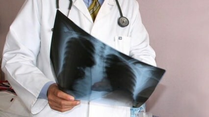 Ogłoszeni eksperci! Wzrost liczby zgonów z powodu raka płuc