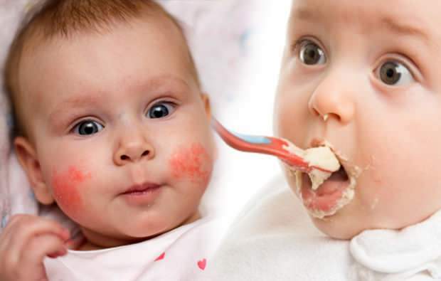 objawy alergii u niemowląt