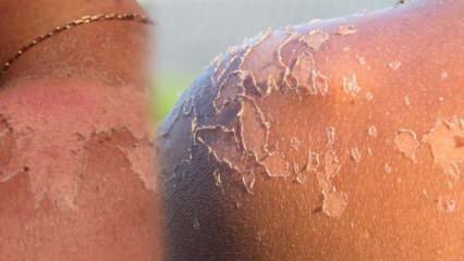 Co jest dobre w peelingu skóry i jak działa peeling? Domowy środek na peeling skóry