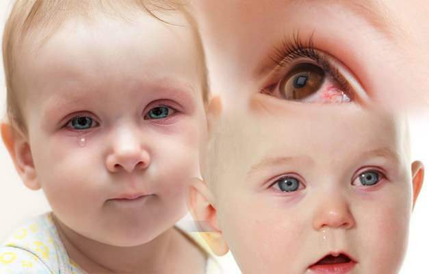 powoduje krwawienie do oczu u niemowląt