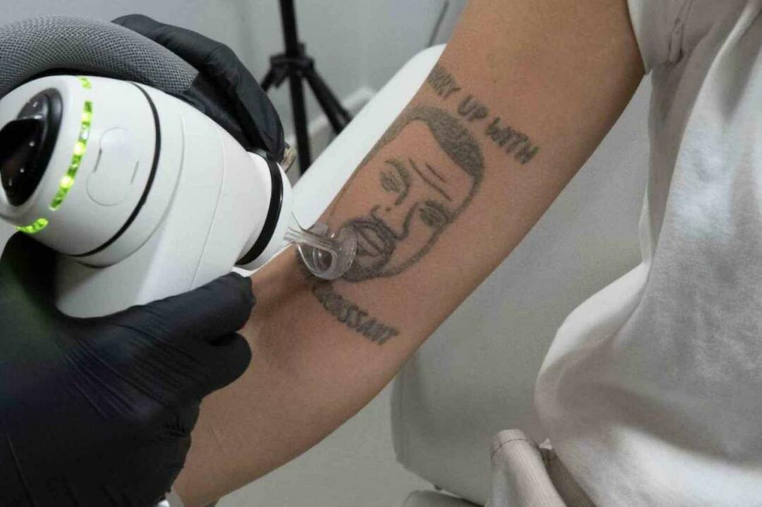 Tatuaż Kanye Westa zostanie usunięty za darmo w Londynie 