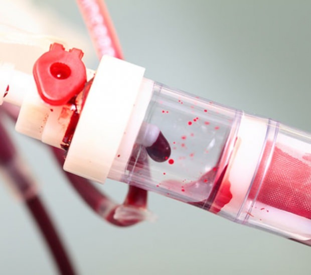 Co to jest niski poziom płytek krwi (PLT)? Jakie są objawy niedoboru płytek krwi?