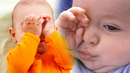 Naturalne rozwiązania na pieczenie oczu u niemowląt