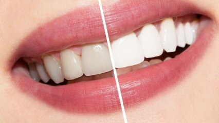 Jakie są zalecenia dotyczące białych zębów? Wybielanie zębów leczy naturalnie w domu ...
