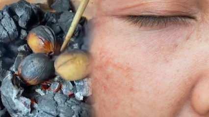 Mieszanka orzechowo-oliwkowa, która usuwa przebarwienia i oparzenia na twarzy!