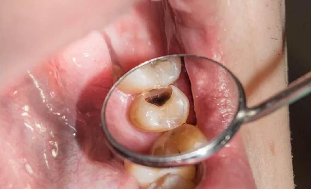 Dlaczego zęby psują się i co możemy zrobić, aby temu zapobiec? 