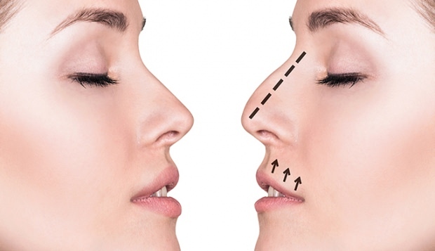 Jak wykonuje się operację nosa? W jakich przypadkach wykonuje się operację plastyki nosa?