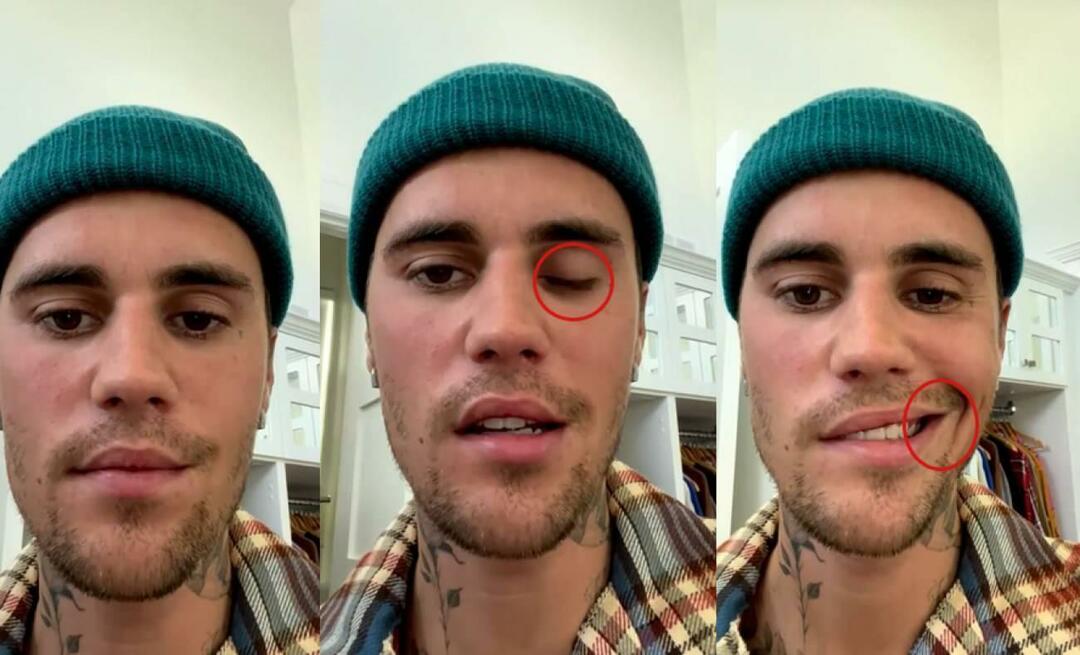 Justin Bieber miał paraliż twarzy! Słynna gwiazda nie może po raz kolejny wyruszyć w światową trasę koncertową