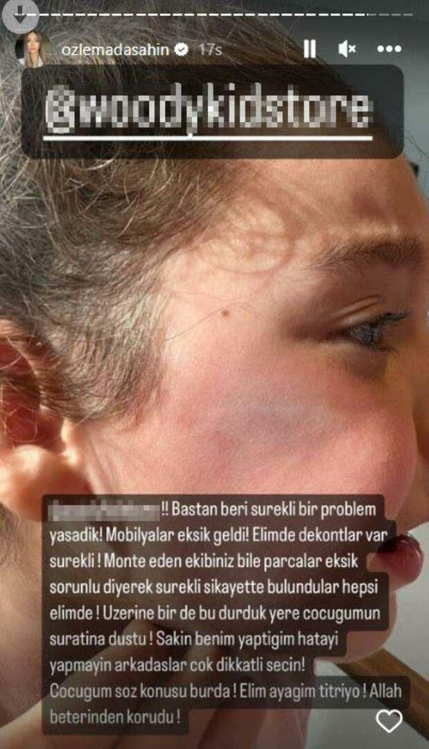 Drzwi szafy spadły na twarz córki Berkay Şahina