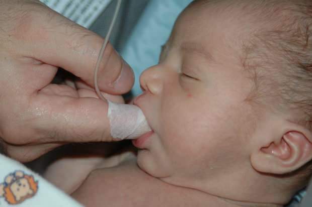 Co to jest metoda karmienia palcami? Jak karmić dziecko strzykawką?
