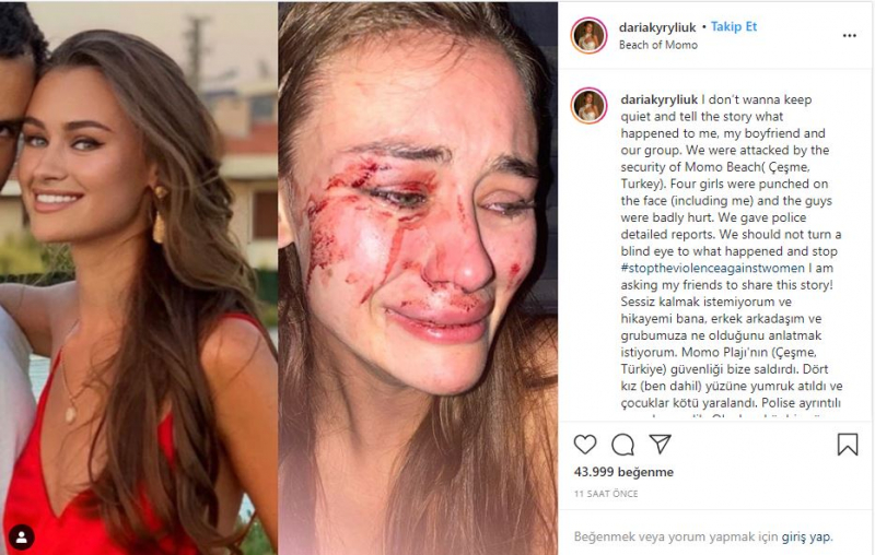 Daria Kyryliuk, ukraińska top modelka rzekomo pobita w İzmir Çeşme, zabrała głos po raz pierwszy!
