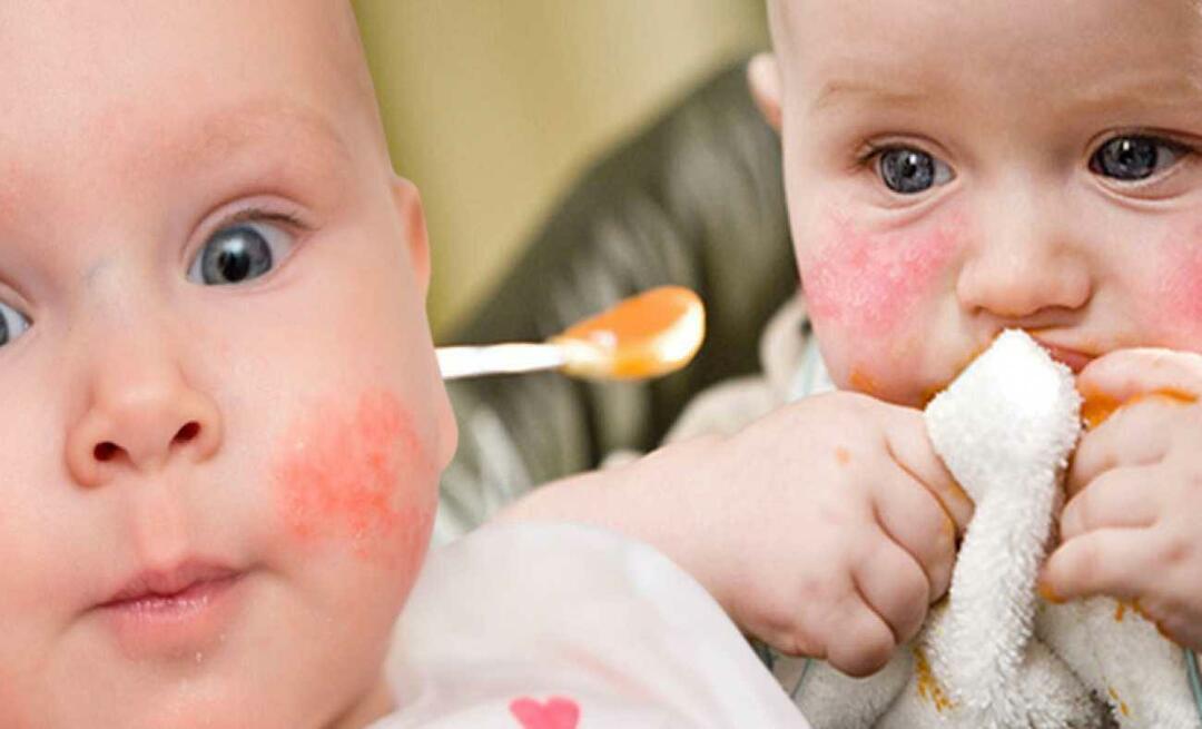 Co powinno jeść dziecko z alergią? Jakie są alternatywne pokarmy dla alergików?