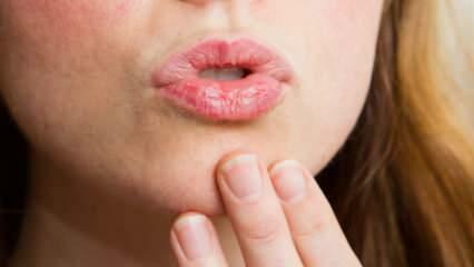 Jak pielęgnować usta domowymi sposobami? Łatwa pielęgnacja suchych ust w 4 krokach