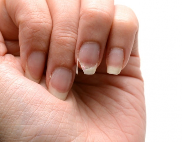Jak odbywa się pielęgnacja paznokci? Szybkie metody przedłużania paznokci