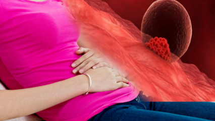 Co to jest krwawienie z implantacji podczas ciąży? Jak odróżnić krwawienie z miejsca ustawienia od krwawienia miesiączkowego