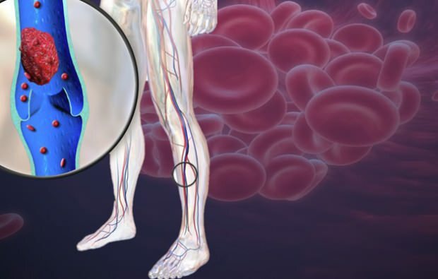 zmniejszone krążenie krwi w żyłach nóg powoduje ból